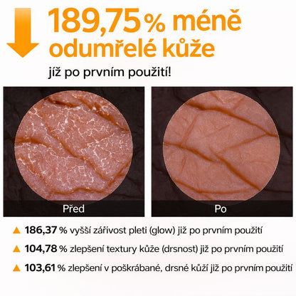 Dr.Melaxin - Exfoliační sprej s kyselinou kojovou a kurkumou